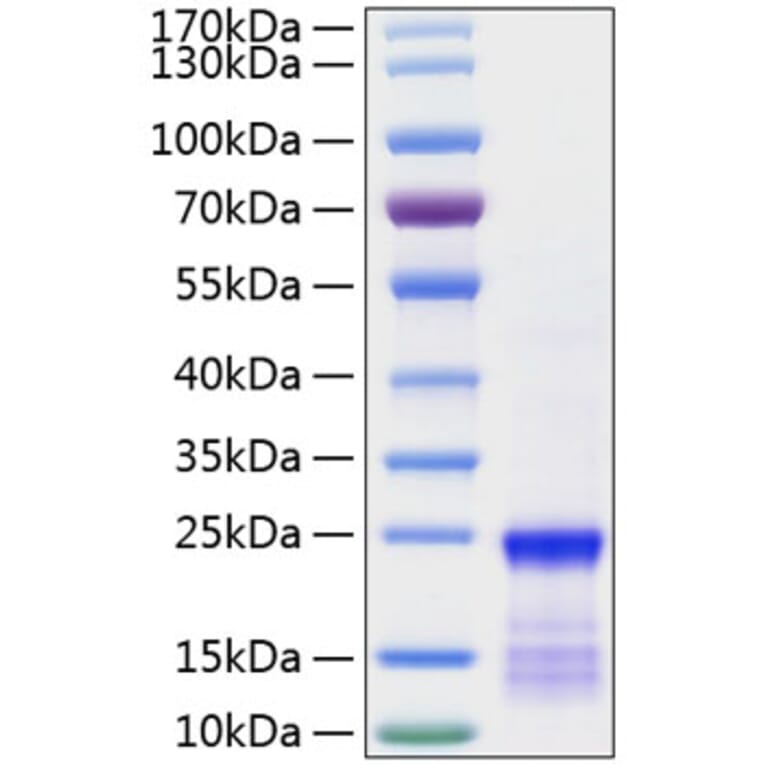 SDS-PAGE - Recombinant Human KRAS Protein (N-terminal His Tag) (A330977) - Antibodies.com