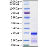 SDS-PAGE - Recombinant Human KRAS Protein (N-terminal His Tag) (A330977) - Antibodies.com