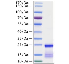 SDS-PAGE - Recombinant Human KRAS Protein (N-terminal His Tag) (A330978) - Antibodies.com