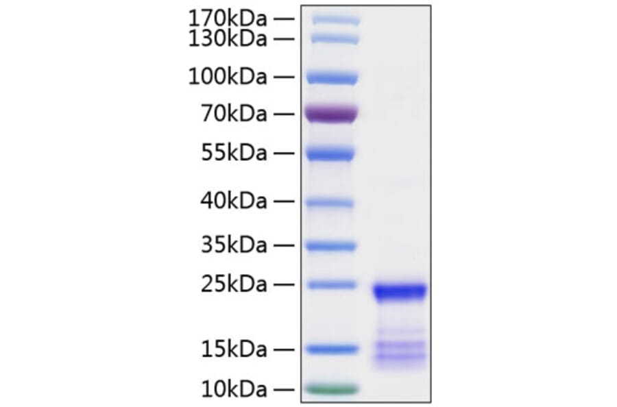 SDS-PAGE - Recombinant Human KRAS Protein (N-terminal His Tag) (A330978) - Antibodies.com
