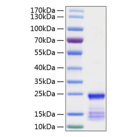 SDS-PAGE - Recombinant Human KRAS Protein (N-terminal His Tag) (A330978) - Antibodies.com