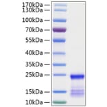 SDS-PAGE - Recombinant Human KRAS Protein (N-terminal His Tag) (A330978) - Antibodies.com