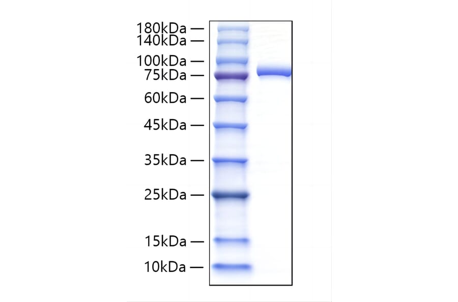 SDS-PAGE - Recombinant Human Lactoferrin Protein (C-terminal His Tag) (A330979) - Antibodies.com