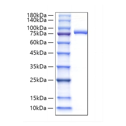 SDS-PAGE - Recombinant Human Lactoferrin Protein (C-terminal His Tag) (A330979) - Antibodies.com