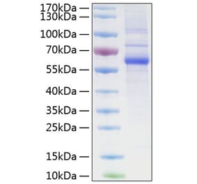 SDS-PAGE - Recombinant Human LAG-3 Protein (C-terminal His Tag) (A330980) - Antibodies.com