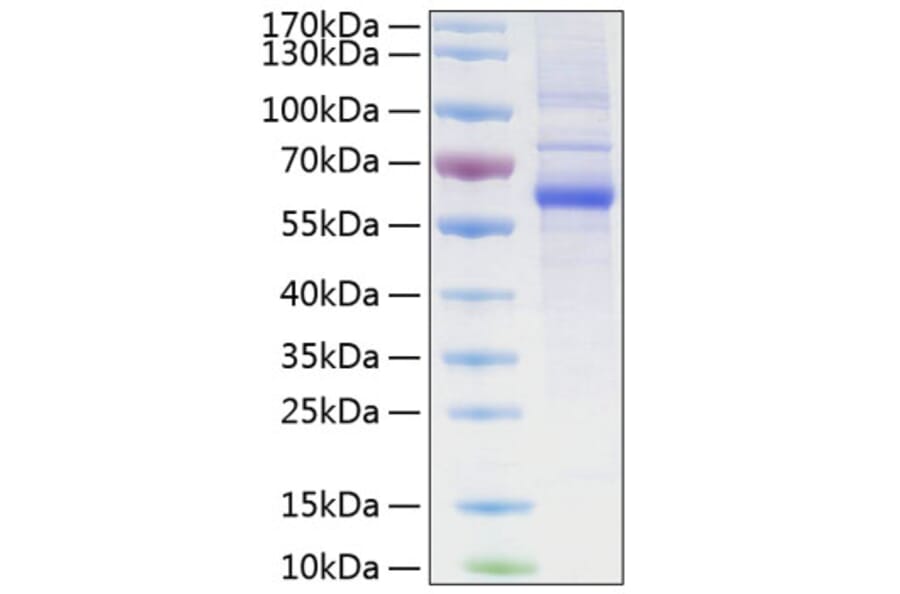 SDS-PAGE - Recombinant Human LAG-3 Protein (C-terminal His Tag) (A330980) - Antibodies.com