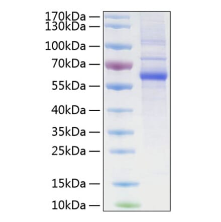 SDS-PAGE - Recombinant Human LAG-3 Protein (C-terminal His Tag) (A330980) - Antibodies.com