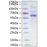 SDS-PAGE - Recombinant Human LAG-3 Protein (C-terminal His Tag) (A330980) - Antibodies.com