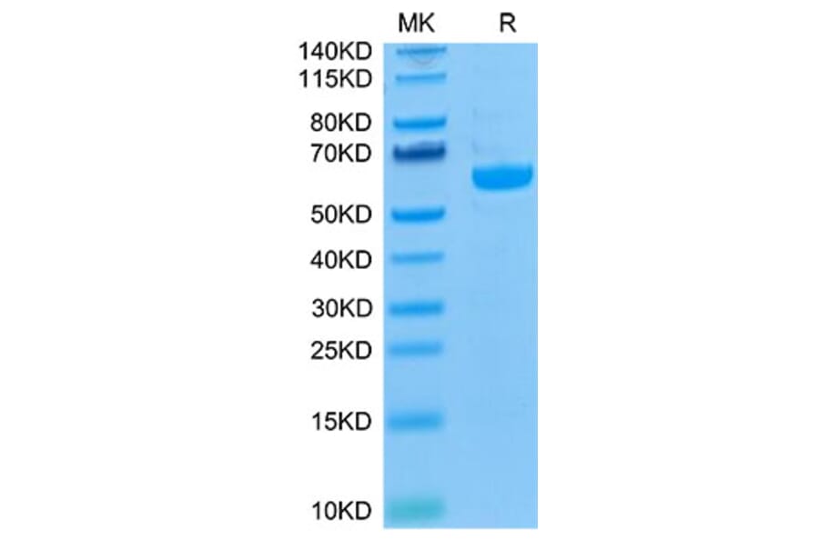 Tris-Bis PAGE - Recombinant Human LAG-3 Protein (Biotin) (C-terminal His and Avi Tag) (A330981) - Antibodies.com