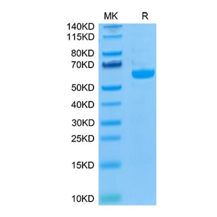Tris-Bis PAGE - Recombinant Human LAG-3 Protein (Biotin) (C-terminal His and Avi Tag) (A330981) - Antibodies.com