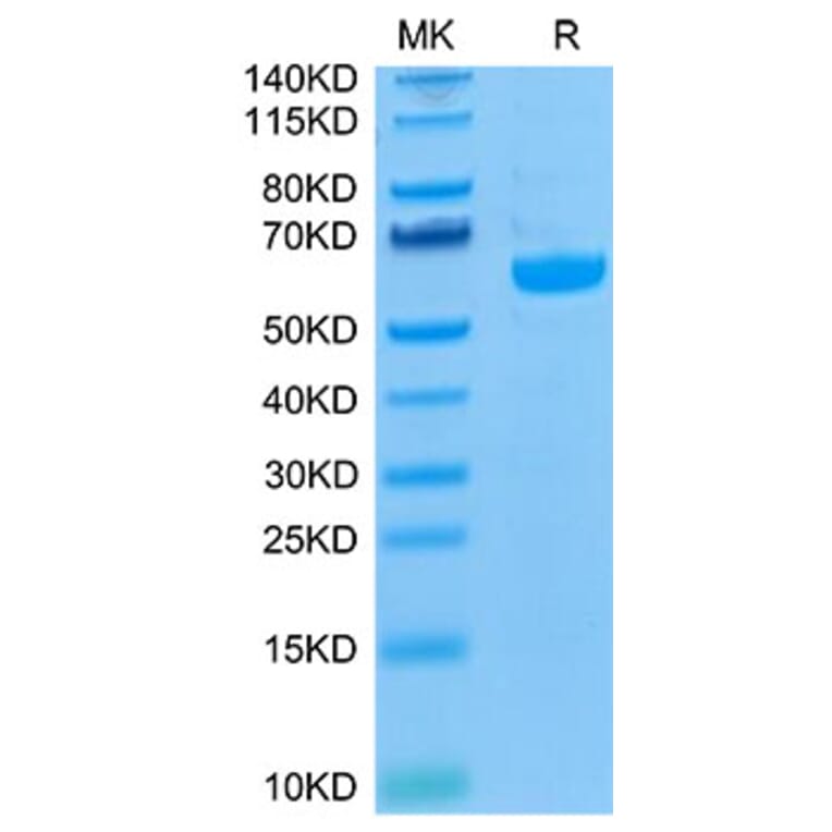 Tris-Bis PAGE - Recombinant Human LAG-3 Protein (Biotin) (C-terminal His and Avi Tag) (A330981) - Antibodies.com