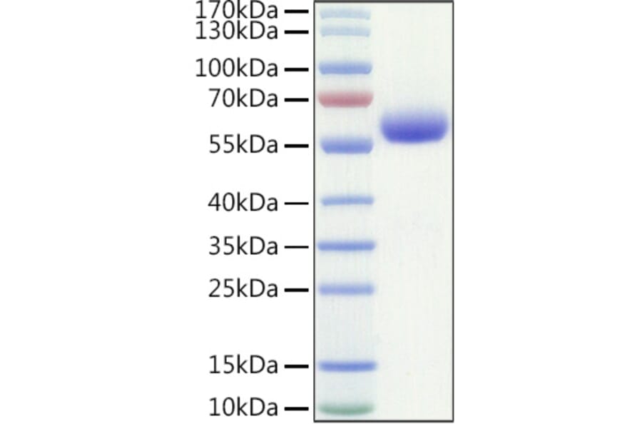 SDS-PAGE - Recombinant Human LAIR1 Protein (C-terminal Human Fc and Avi Tag) (A330982) - Antibodies.com