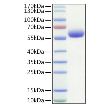 SDS-PAGE - Recombinant Human LAIR1 Protein (C-terminal Human Fc and Avi Tag) (A330982) - Antibodies.com