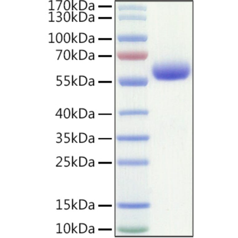 SDS-PAGE - Recombinant Human LAIR1 Protein (C-terminal Human Fc and Avi Tag) (A330982) - Antibodies.com