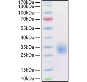 SDS-PAGE - Recombinant Human LAIR1 Protein (C-terminal His and Avi Tag) (A330983) - Antibodies.com