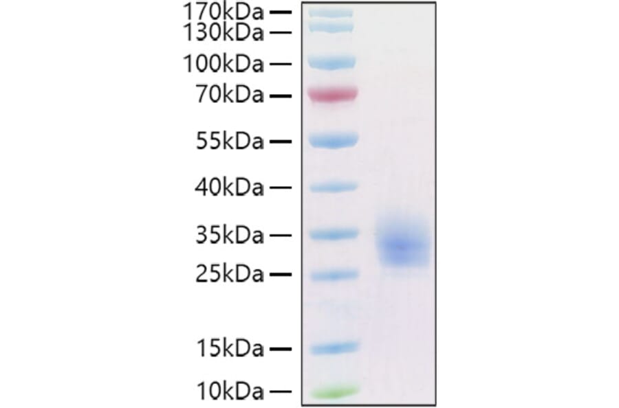 SDS-PAGE - Recombinant Human LAIR1 Protein (C-terminal His and Avi Tag) (A330983) - Antibodies.com