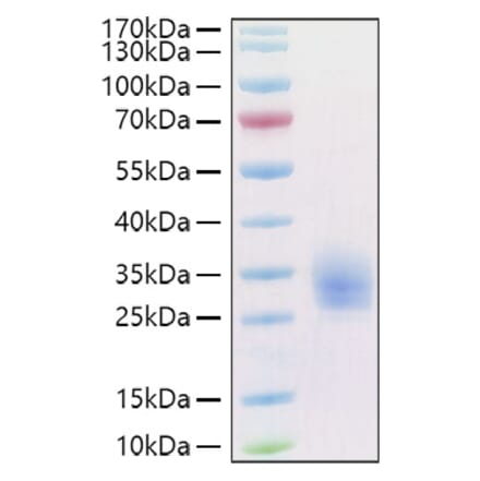 SDS-PAGE - Recombinant Human LAIR1 Protein (C-terminal His and Avi Tag) (A330983) - Antibodies.com