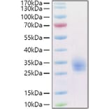 SDS-PAGE - Recombinant Human LAIR1 Protein (C-terminal His and Avi Tag) (A330983) - Antibodies.com