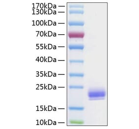 SDS-PAGE - Recombinant Human LAIR2 Protein (C-terminal His Tag) (A330984) - Antibodies.com