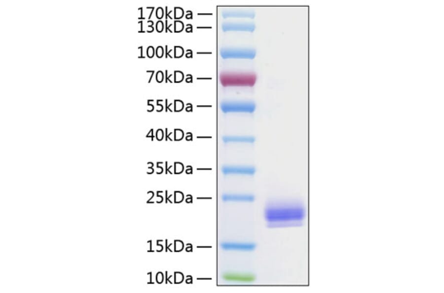 SDS-PAGE - Recombinant Human LAIR2 Protein (C-terminal His Tag) (A330984) - Antibodies.com