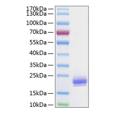 SDS-PAGE - Recombinant Human LAIR2 Protein (C-terminal His Tag) (A330984) - Antibodies.com