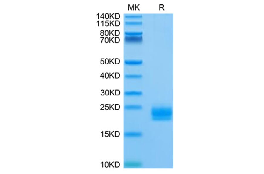 Tris-Bis PAGE - Recombinant Human LAIR2 Protein (Biotin) (C-terminal His and Avi Tag) (A330985) - Antibodies.com