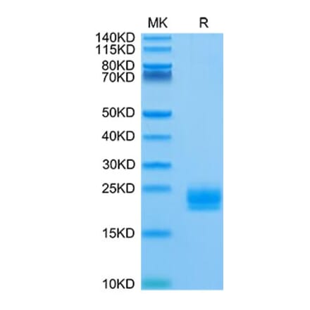 Tris-Bis PAGE - Recombinant Human LAIR2 Protein (Biotin) (C-terminal His and Avi Tag) (A330985) - Antibodies.com