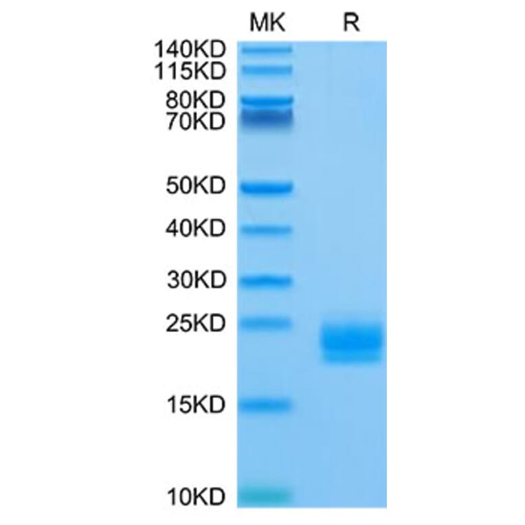Tris-Bis PAGE - Recombinant Human LAIR2 Protein (Biotin) (C-terminal His and Avi Tag) (A330985) - Antibodies.com