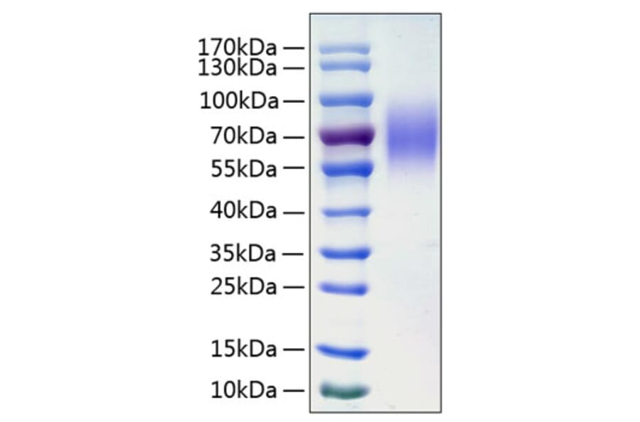 SDS-PAGE - Recombinant Human LAMP1 Protein (C-terminal His Tag) (A330986) - Antibodies.com