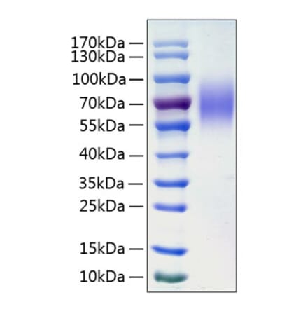 SDS-PAGE - Recombinant Human LAMP1 Protein (C-terminal His Tag) (A330986) - Antibodies.com