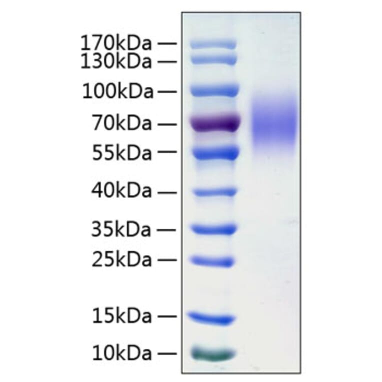 SDS-PAGE - Recombinant Human LAMP1 Protein (C-terminal His Tag) (A330986) - Antibodies.com