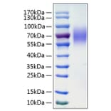 SDS-PAGE - Recombinant Human LAMP1 Protein (C-terminal His Tag) (A330986) - Antibodies.com