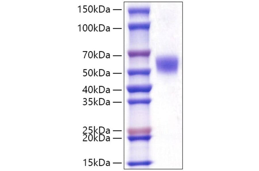SDS-PAGE - Recombinant Human LAP3 Protein (C-terminal His Tag) (A330987) - Antibodies.com