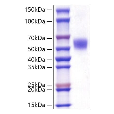 SDS-PAGE - Recombinant Human LAP3 Protein (C-terminal His Tag) (A330987) - Antibodies.com