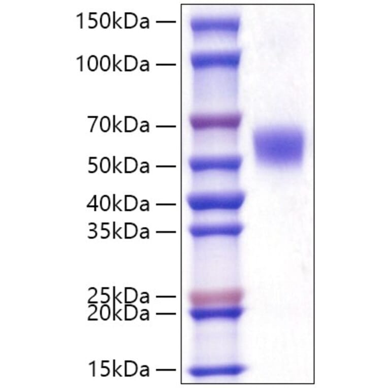 SDS-PAGE - Recombinant Human LAP3 Protein (C-terminal His Tag) (A330987) - Antibodies.com