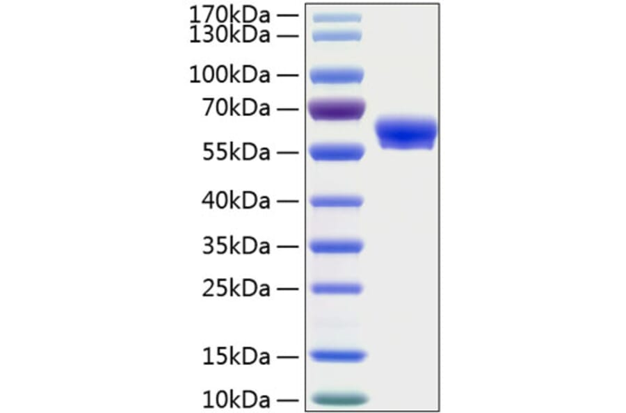SDS-PAGE - Recombinant Human LAYN Protein (C-terminal Human Fc and His Tag) (A330988) - Antibodies.com