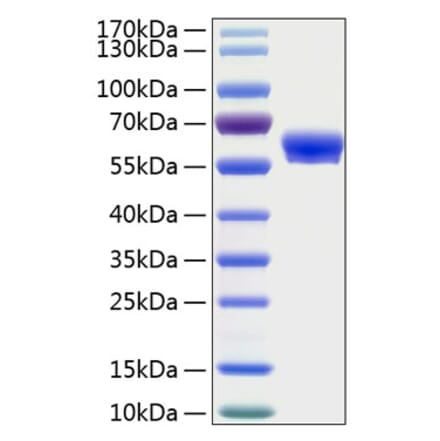 SDS-PAGE - Recombinant Human LAYN Protein (C-terminal Human Fc and His Tag) (A330988) - Antibodies.com