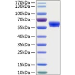 SDS-PAGE - Recombinant Human LAYN Protein (C-terminal Human Fc and His Tag) (A330988) - Antibodies.com