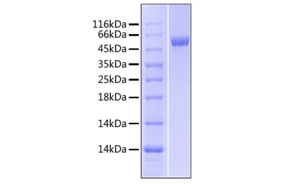 SDS-PAGE - Recombinant Human LBP Protein (C-terminal His Tag) (A330989) - Antibodies.com