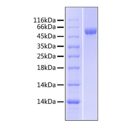 SDS-PAGE - Recombinant Human LBP Protein (C-terminal His Tag) (A330989) - Antibodies.com