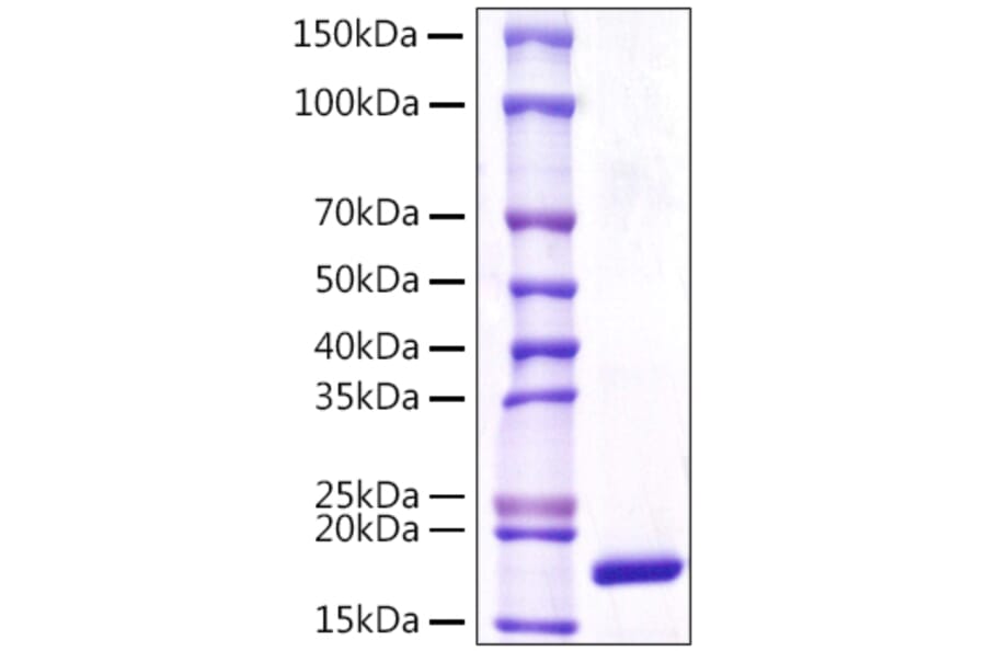 SDS-PAGE - Recombinant Human LCN1 Protein (C-terminal His Tag) (A330990) - Antibodies.com