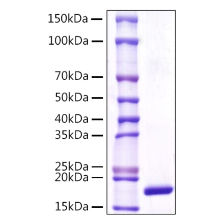 SDS-PAGE - Recombinant Human LCN1 Protein (C-terminal His Tag) (A330990) - Antibodies.com