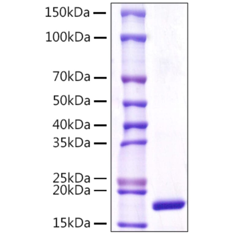 SDS-PAGE - Recombinant Human LCN1 Protein (C-terminal His Tag) (A330990) - Antibodies.com