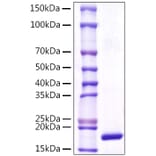 SDS-PAGE - Recombinant Human LCN1 Protein (C-terminal His Tag) (A330990) - Antibodies.com