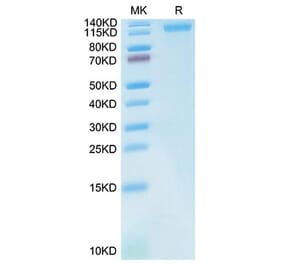 Tris-Bis PAGE - Recombinant Cynomolgus macaque LDLR Protein (C-terminal His Tag) (A330991) - Antibodies.com