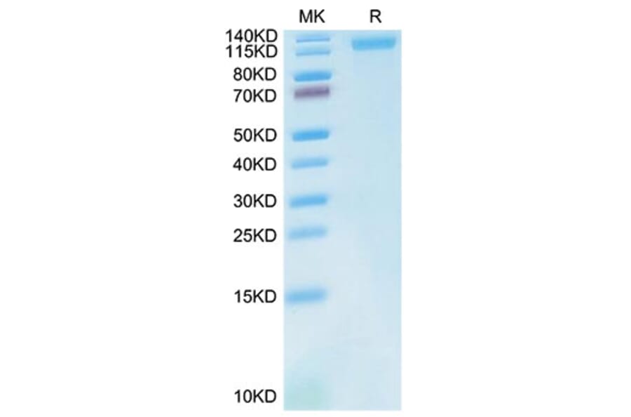 Tris-Bis PAGE - Recombinant Cynomolgus macaque LDLR Protein (C-terminal His Tag) (A330991) - Antibodies.com