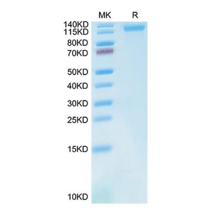 Tris-Bis PAGE - Recombinant Cynomolgus macaque LDLR Protein (C-terminal His Tag) (A330991) - Antibodies.com