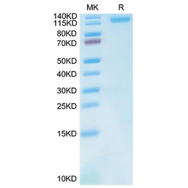 Tris-Bis PAGE - Recombinant Cynomolgus macaque LDLR Protein (C-terminal His Tag) (A330991) - Antibodies.com