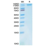 Tris-Bis PAGE - Recombinant Cynomolgus macaque LDLR Protein (C-terminal His Tag) (A330991) - Antibodies.com