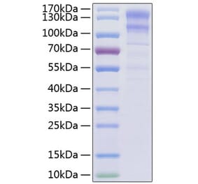 SDS-PAGE - Recombinant Human LDLR Protein (C-terminal His Tag) (A330992) - Antibodies.com